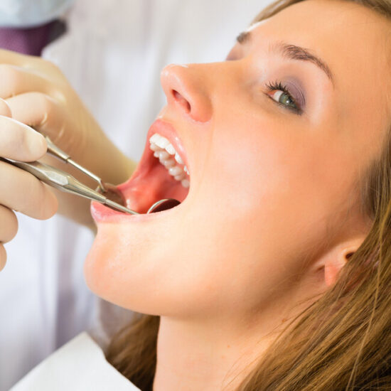 Tooth Extraction