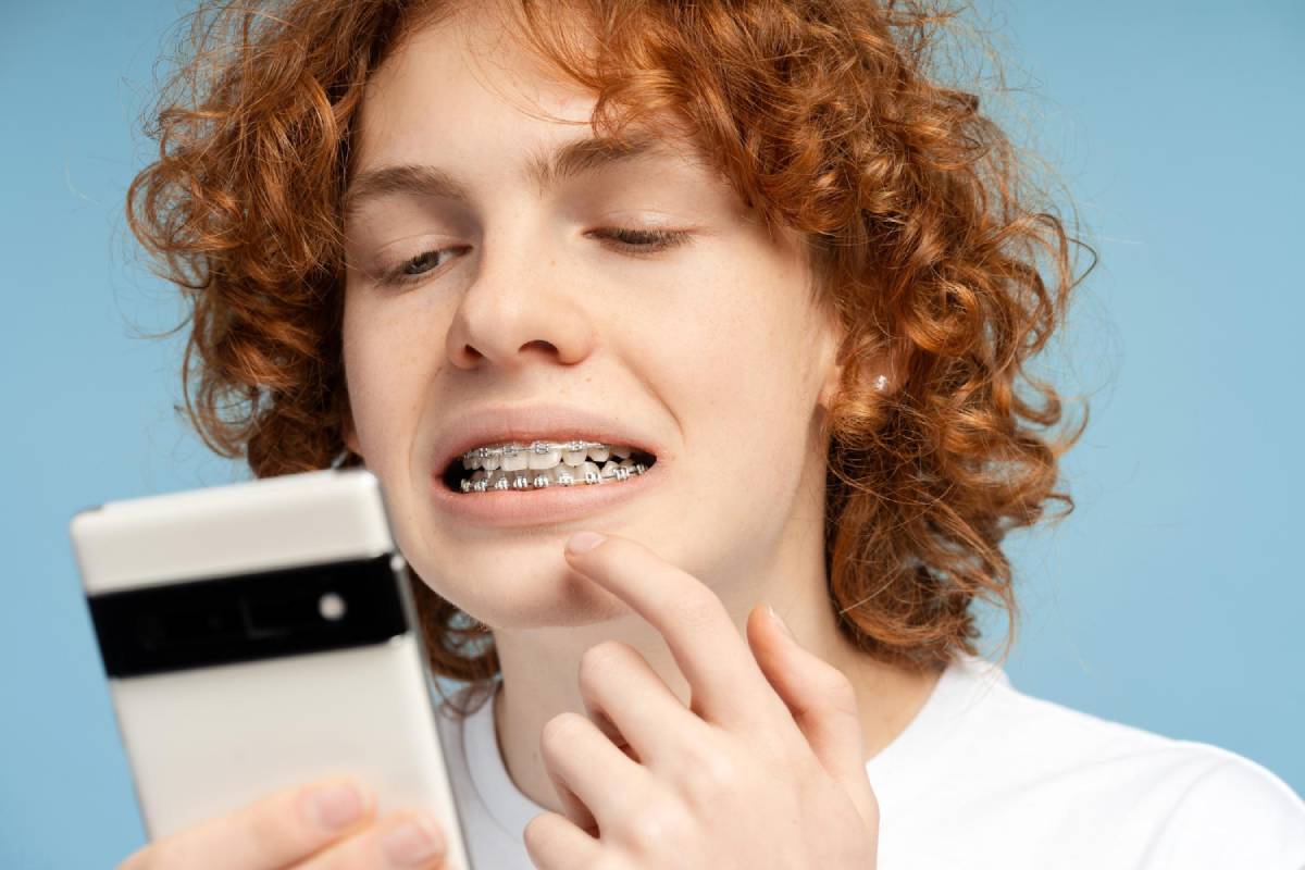 Invisible Braces: Are They Worth It?