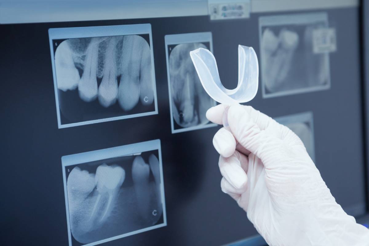 How Safe Is Dental Treatment Today?