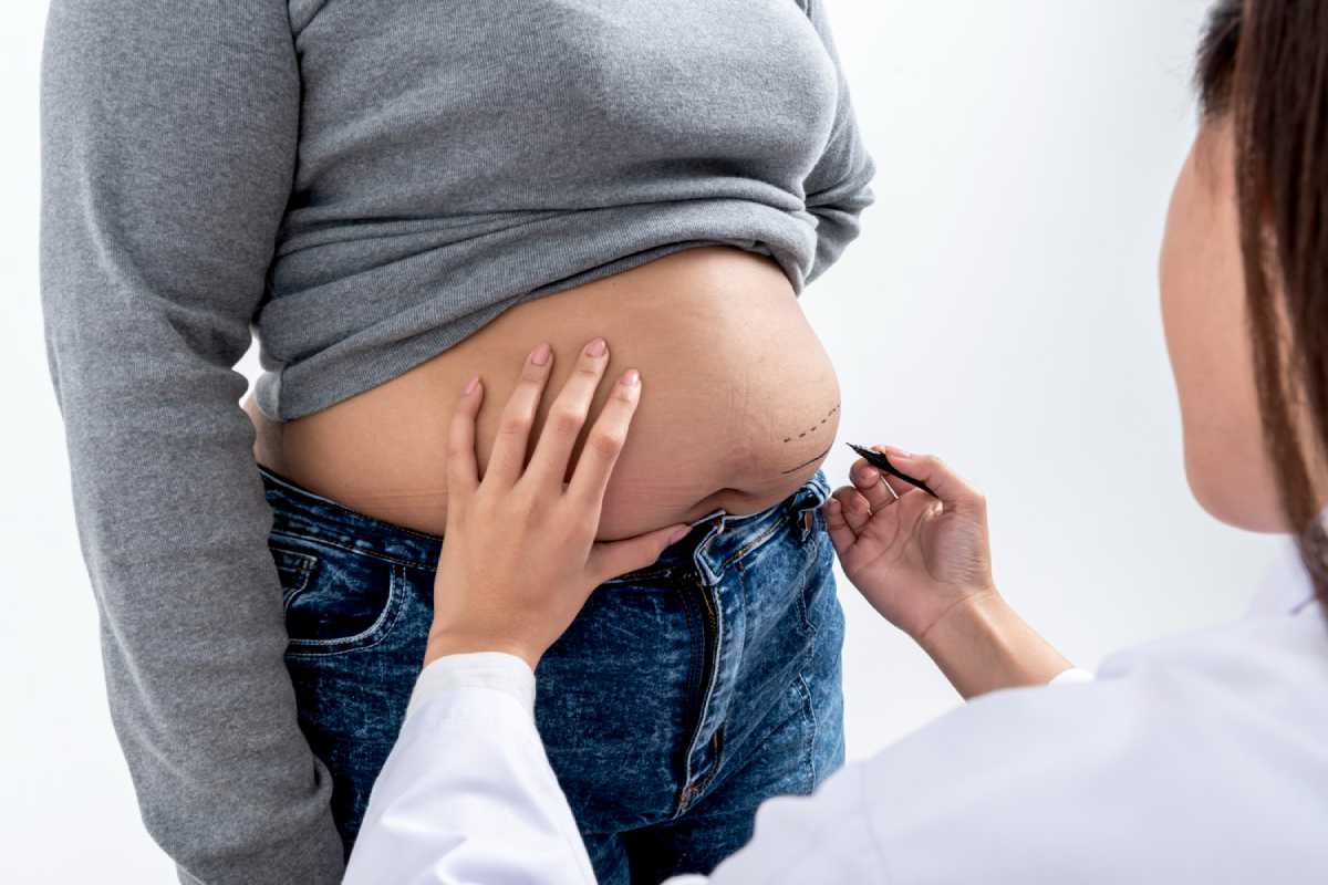 Life-Changing Benefits of Obesity Surgery