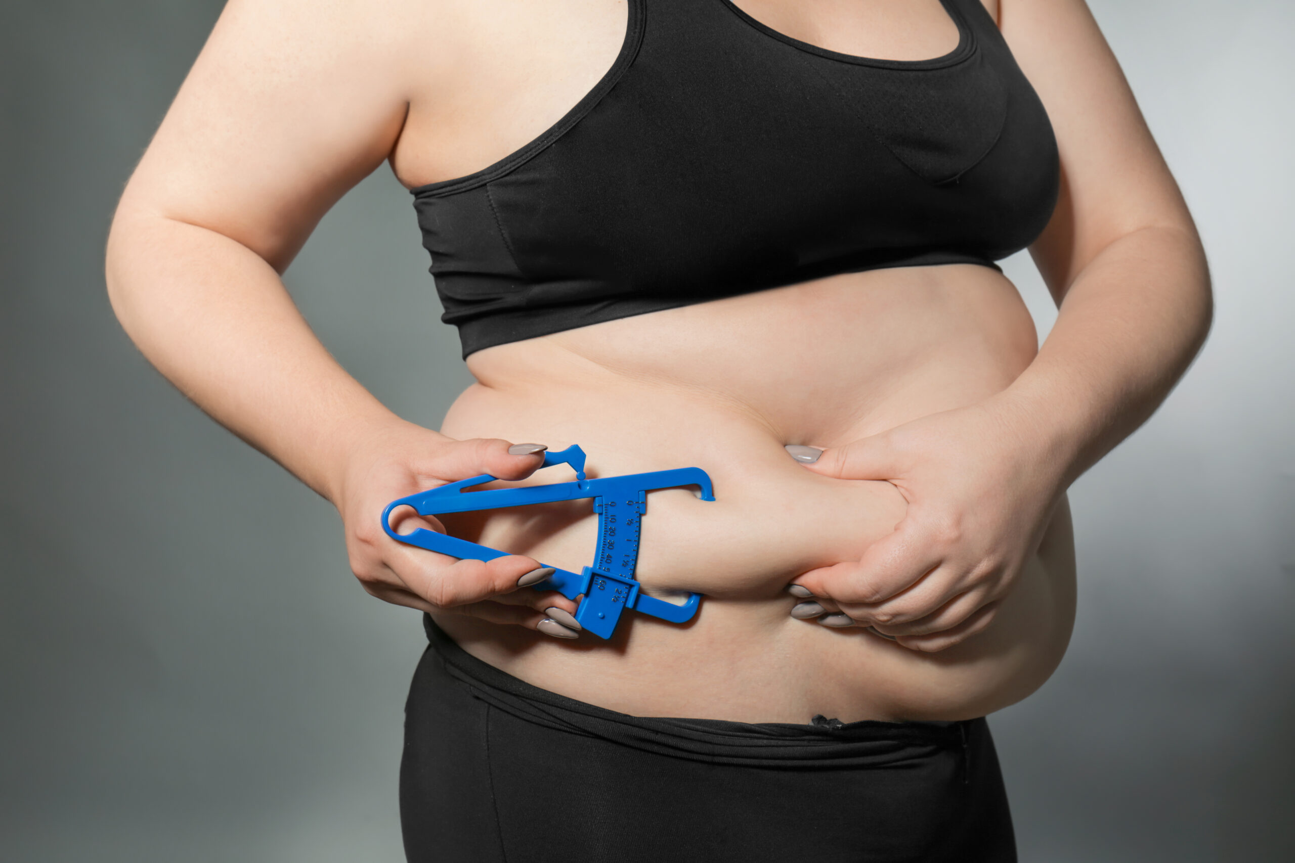Obesity Surgery: A Step-by-Step Guide