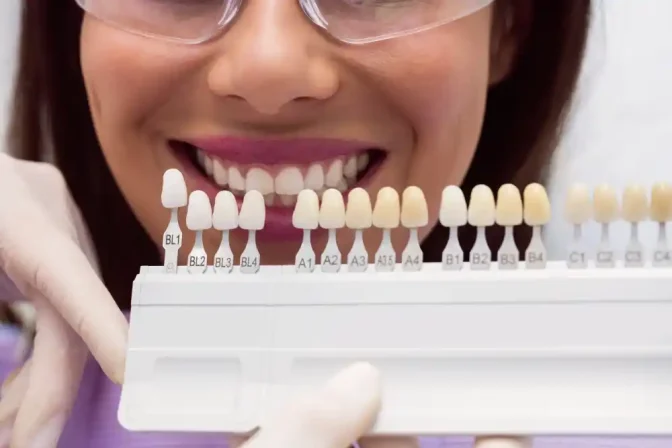 Porcelain Veneers: The Gold Standard for a Flawless Aesthetic Transformation