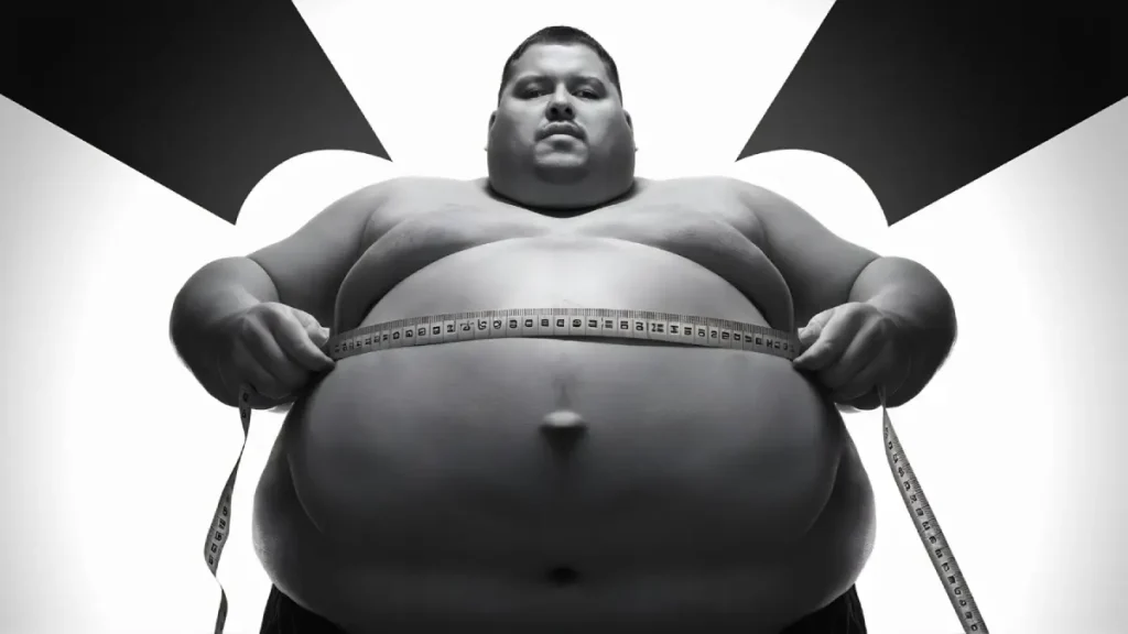 Obesity Surgery