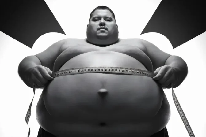 Obesity Surgery: Your Strategic Roadmap to Health
