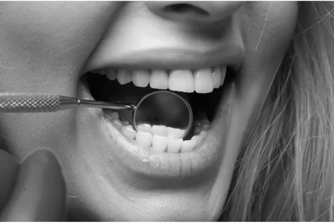Dental Treatment Innovations: Complete Guide to Radiant Smiles